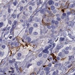 GPR50 Antibody, Novus Biologicals 25 &mu;L, Unlabeled:Antibodies, Polyclonal